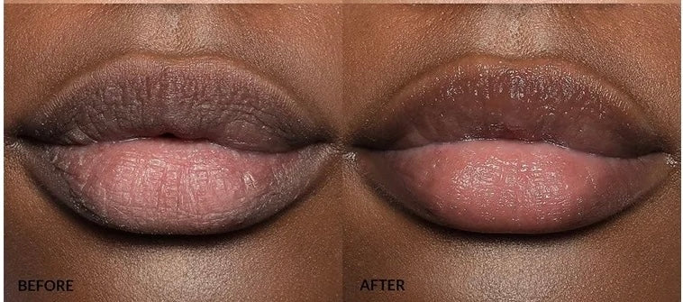 LIPS TREATMENT