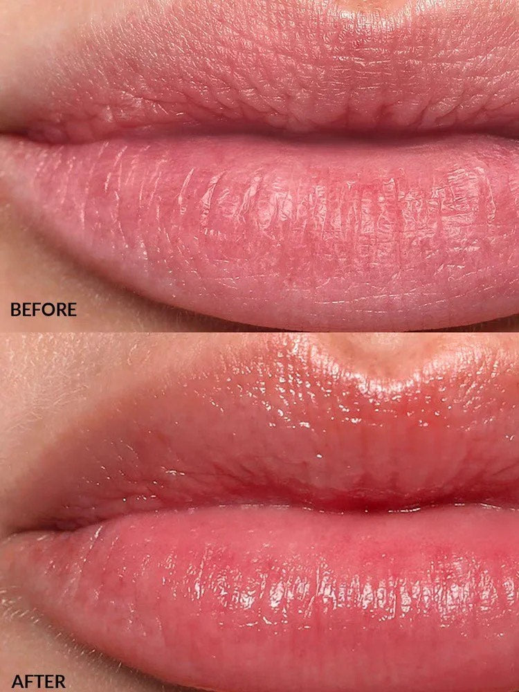 LIPS TREATMENT